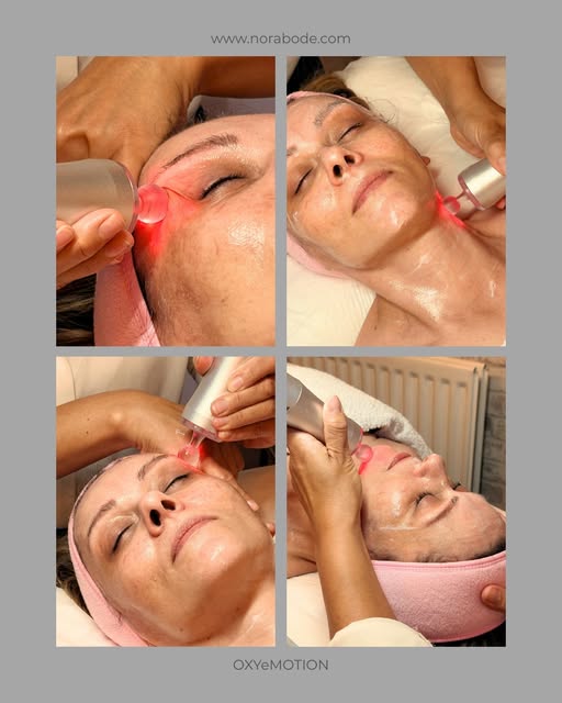 Vier toepassingen van de OXYeMOTION-applicator tijdens een professionele behandeling