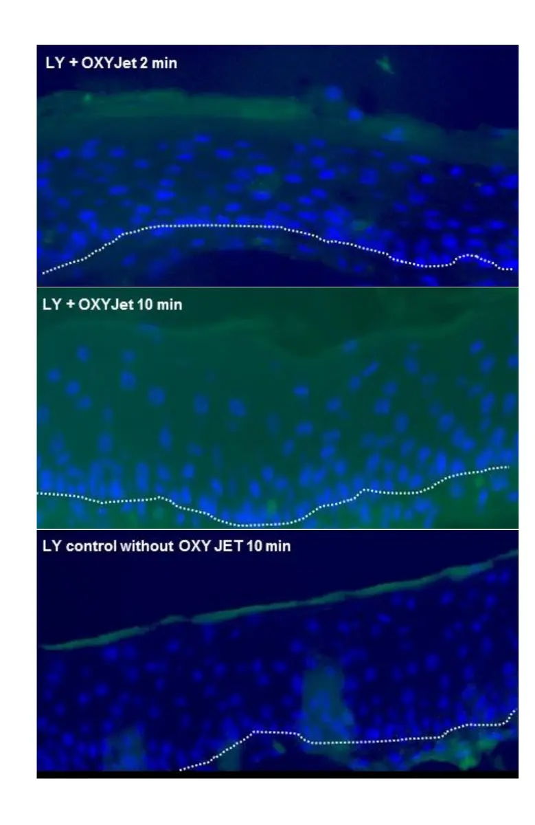 Dermatest fluorescentiebeelden met OXYjet na twee en tien minuten en een controle zonder OXYjet